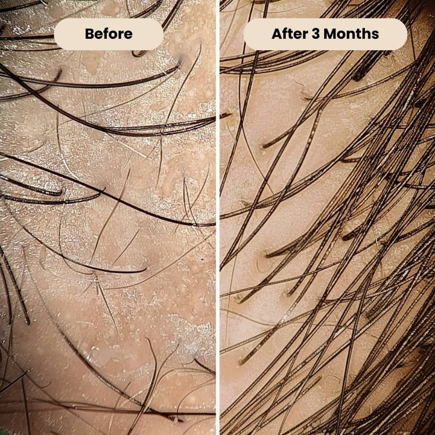 THRIVE Peptide Hair Serum