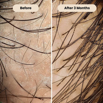 THRIVE Peptide Hair Serum